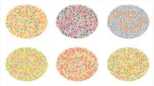 עיוורון צבעים